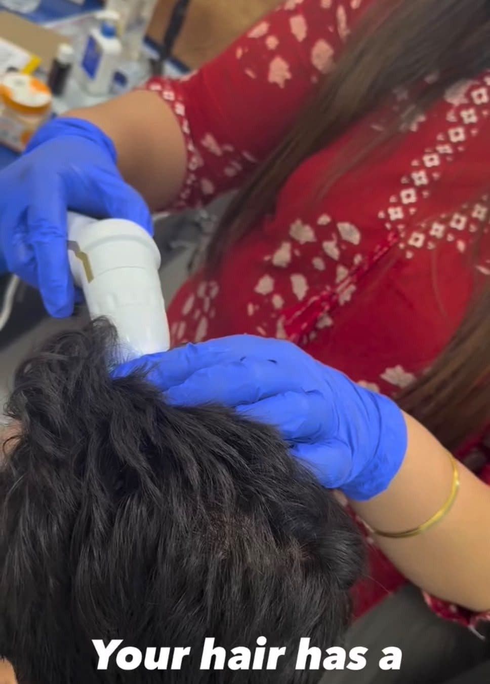 Scalp analysis session